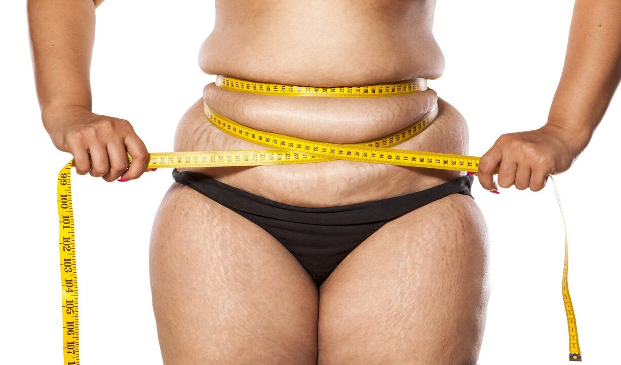 Excess weight and weight loss using Keto Probiotix
